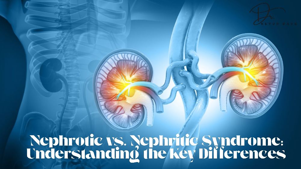 Nephrotic vs. Nephritic Syndrome Understanding the Key Differences